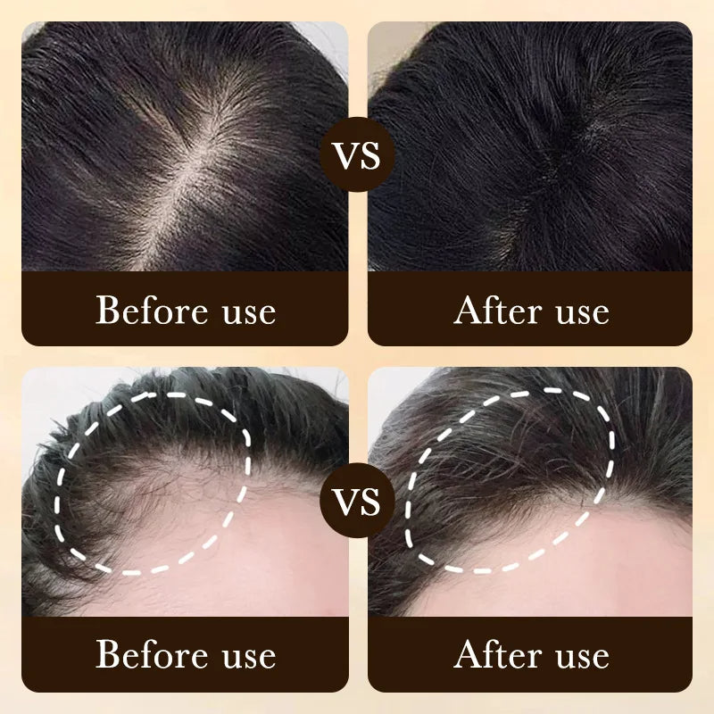 Fast Hair Growth