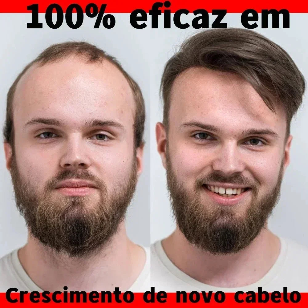 Fast Hair Growth